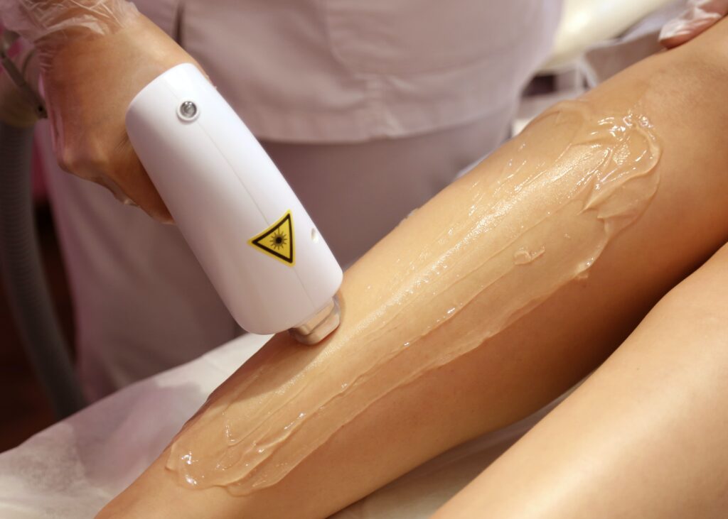 Epilation laser by Sophie Festré épilation laser jambes complètes