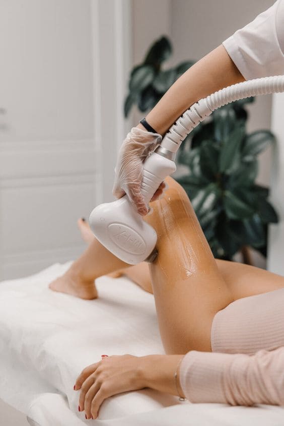 Epilation laser by sophie festre epilation jambes femmes